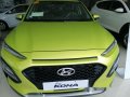 Hyundai Kona 2018 for sale-6