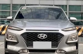 2020 Hyundai Kona 2.0 Gls AT Gas 🔥𝕁𝔼𝕊𝕊𝔼ℕ 𝕄𝔼ℕ𝔻𝕆ℤ𝔸 🙋‍♂️☎️  09279850198