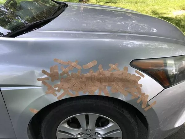 Wound tapes for car’s wound
