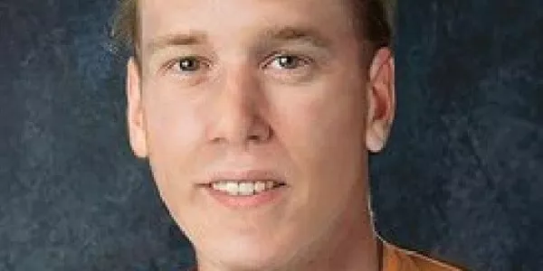 Picture of  the facial reconstruction of Volkswagen Vanagon accident's victim