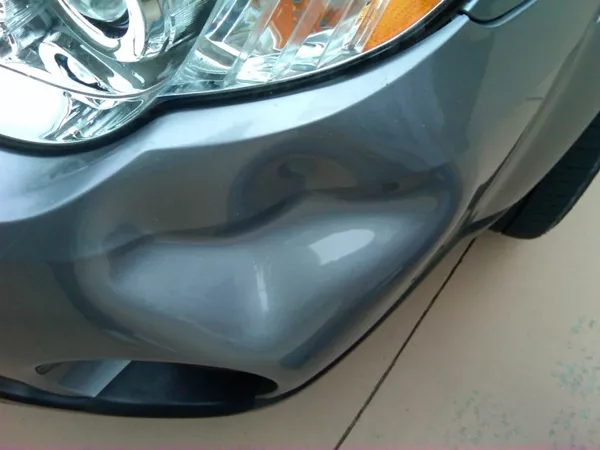 car dent