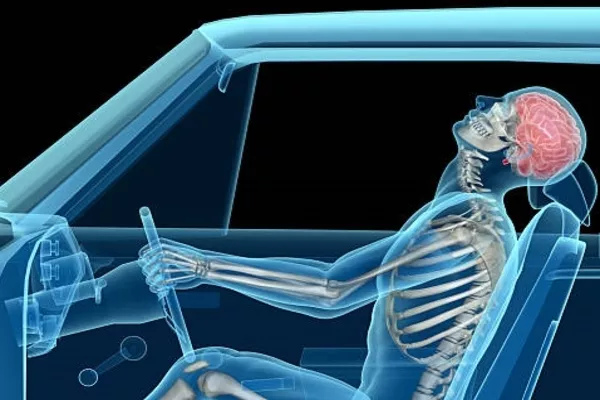 whiplash illustration